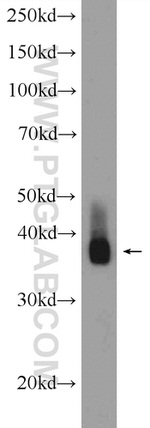 CPB1 Antibody in Western Blot (WB)