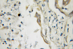 CPB1 Antibody in Immunohistochemistry (Paraffin) (IHC (P))