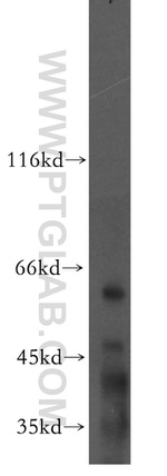 MAOB Antibody in Western Blot (WB)