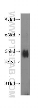 IPPK Antibody in Western Blot (WB)