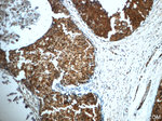 TRPC4AP Antibody in Immunohistochemistry (Paraffin) (IHC (P))