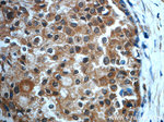 TRPC4AP Antibody in Immunohistochemistry (Paraffin) (IHC (P))