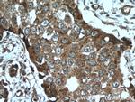 TRPC4AP Antibody in Immunohistochemistry (Paraffin) (IHC (P))