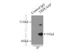 TRPC4AP Antibody in Immunoprecipitation (IP)