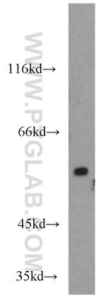 TRIM23 Antibody in Western Blot (WB)