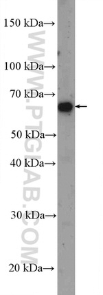 TRIM23 Antibody in Western Blot (WB)