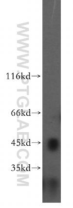 USP12 Antibody in Western Blot (WB)