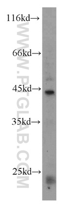 USP12 Antibody in Western Blot (WB)