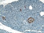 ACVR1C Antibody in Immunohistochemistry (Paraffin) (IHC (P))