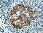 ACVR1C Antibody in Immunohistochemistry (Paraffin) (IHC (P))
