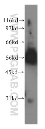 ACVR1C Antibody in Western Blot (WB)