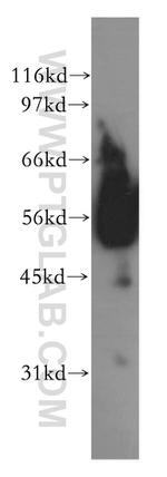 ACVR1C Antibody in Western Blot (WB)
