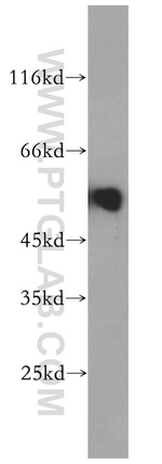 ACVR1C Antibody in Western Blot (WB)