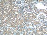 ECOP Antibody in Immunohistochemistry (Paraffin) (IHC (P))