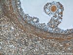 ECOP Antibody in Immunohistochemistry (Paraffin) (IHC (P))