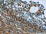 ECOP Antibody in Immunohistochemistry (Paraffin) (IHC (P))