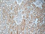 ECOP Antibody in Immunohistochemistry (Paraffin) (IHC (P))