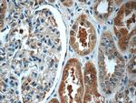 ECOP Antibody in Immunohistochemistry (Paraffin) (IHC (P))