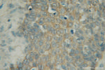 PIGB Antibody in Immunohistochemistry (Paraffin) (IHC (P))