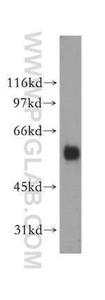 PIGB Antibody in Western Blot (WB)