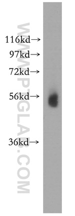 PIGB Antibody in Western Blot (WB)