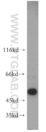 PIGB Antibody in Western Blot (WB)