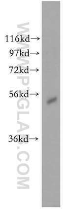 PIGB Antibody in Western Blot (WB)