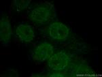 HOXB7 Antibody in Immunocytochemistry (ICC/IF)