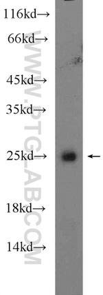 HOXB7 Antibody in Western Blot (WB)