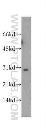 SCO1 Antibody in Western Blot (WB)