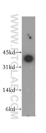 MKI67IP Antibody in Western Blot (WB)