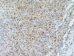 MKI67IP Antibody in Immunohistochemistry (Paraffin) (IHC (P))
