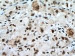 MKI67IP Antibody in Immunohistochemistry (Paraffin) (IHC (P))
