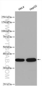 MKI67IP Antibody in Western Blot (WB)
