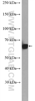 VPS45 Antibody in Western Blot (WB)