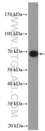 VPS45 Antibody in Western Blot (WB)