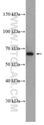 VPS45 Antibody in Western Blot (WB)
