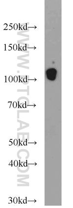 Cadherin-13 Antibody in Western Blot (WB)