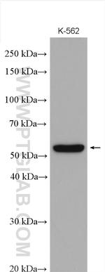 MICA Antibody in Western Blot (WB)