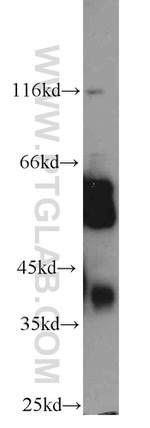 MICA Antibody in Western Blot (WB)