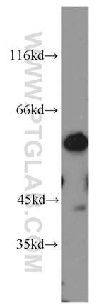 MICA Antibody in Western Blot (WB)