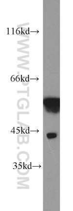 MICA Antibody in Western Blot (WB)