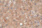 PPP2R1B Antibody in Immunohistochemistry (Paraffin) (IHC (P))