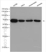 PPP2R1B Antibody in Western Blot (WB)