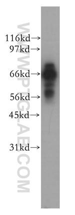 PPP2R1B Antibody in Western Blot (WB)