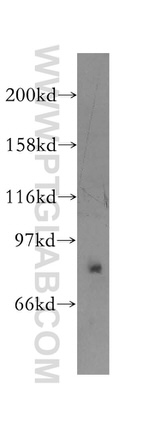 PPP2R1B Antibody in Western Blot (WB)