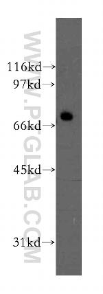 PPP2R1B Antibody in Western Blot (WB)
