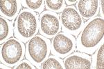 RFX2 Antibody in Immunohistochemistry (Paraffin) (IHC (P))