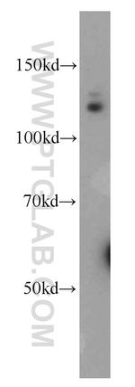 RBBP8 Antibody in Western Blot (WB)