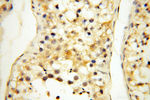 LAMP3 Antibody in Immunohistochemistry (Paraffin) (IHC (P))